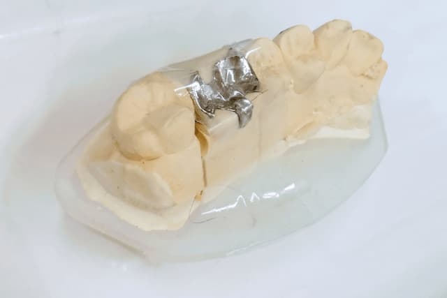 セラミック歯イメージ
