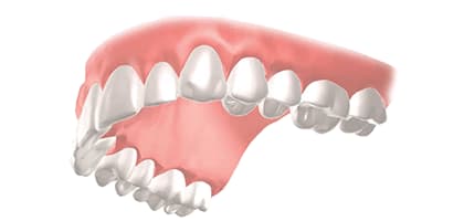 歯茎のイメージ